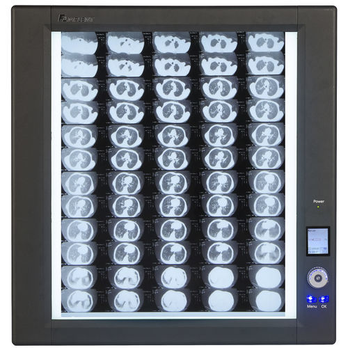 Цифровой негатоскоп - Trimline - Wolf X-Ray Corporation - 1 диапазон / 2 диапазона / 4 диапазона