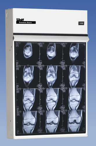 Традиционный негатоскоп - Trimline Basic - Wolf X-Ray Corporation - многодиапазонный