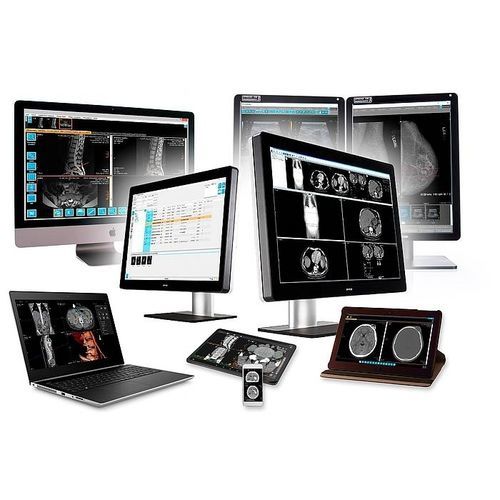PACS для медицинских снимков - IMAGE Information Systems - для больницы