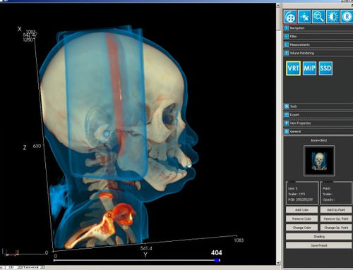 Модуль программного обеспечения для медицинских снимков - iQ-3D - IMAGE Information Systems - для визуализации 3D / для постобработки / для планшетного ПК
