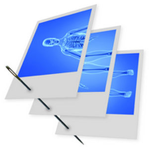 Программное обеспечение для управления данными - Stitching  - IMAGE Information Systems - для приобретения / слияние многорежимных изображений / для ортопедической визуализации