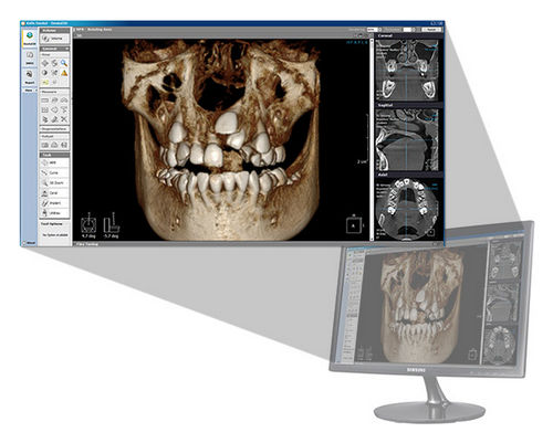 Программное обеспечение для обработки снимков зубов - Xelis 3D - LED Dental - для стоматологии / для визуализации 3D / для анализа