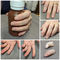 эстетический протез пальцаLifelikeMedical Art Prosthetics
