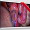медицинский мониторEndoVue PlusNDS Surgical Imaging