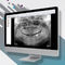 программное обеспечение для визуализацииOMSCarestream Dental