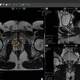 программное обеспечение для диагностики рака простаты / медицинское / для системы архивации и передачи изображений / для управления