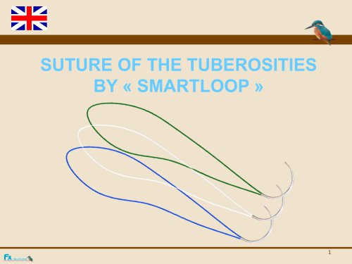 SMARTLOOP