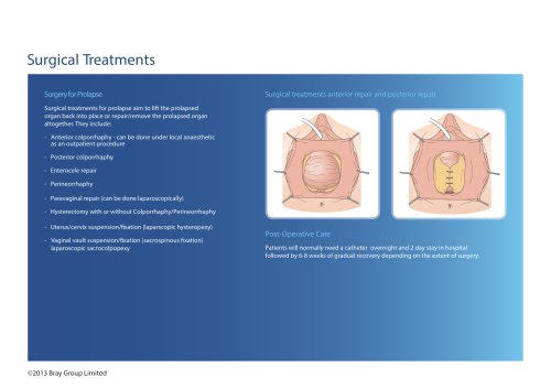 Surgical  Treatments