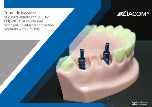 Open tray impression technique on internal connection  implants with ZPLUS®