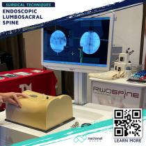 10476 - ENDOSCOPIC LUMBOSACRAL SPINE