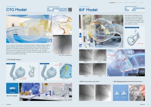 HEARTROID _CORONARY_CTO  BIF Model