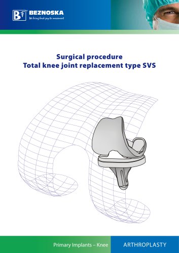 Surgical procedure Total knee joint replacement type SVS