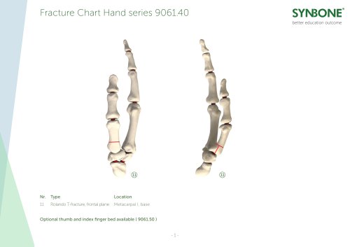 Fracture Chart Thumb and Index Finger 9061.40 model