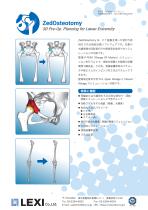 ZedOsteotomy