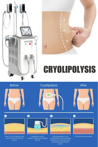 body slimming fat freezing machine best professional cryolipolysis machine