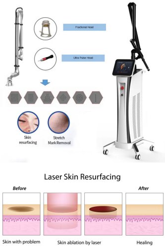 CO2 resurfacing laser dermatology best CO2 fractional laser machine sale