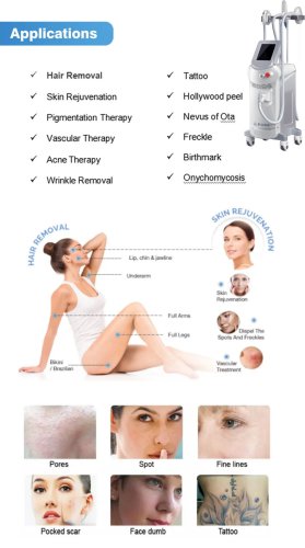 diode laser hair removal+IPL+Q switched ND YAG laser 3 in 1 multifunctional laser beauty machine