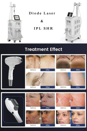 Diode laser hair removal machine & IPL SHR laser machine supplier-BVLASER. The best laser hair removal machine. Permanent laser hair removal. IPL laser facial rejuvenation.