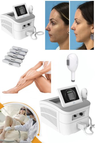 professional IPL photofacial machine for skin rejuvenation