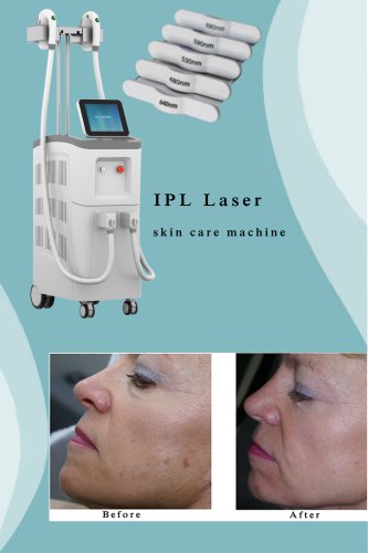 The best IPL laser machine professional. IPL laser skin care machine. IPL laser machine manufacturer and supplier-BVALSER.