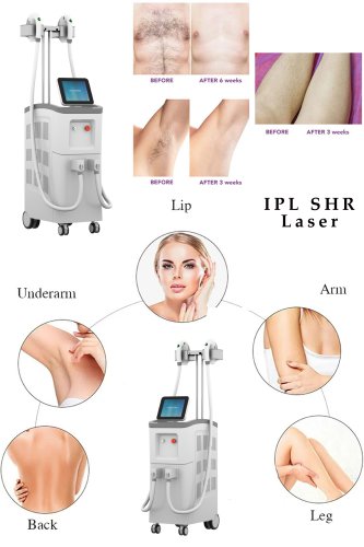 The best professional IPL laser hair removal machine supplier. OPT SHR IPL laser. IPL laser skin care machine.