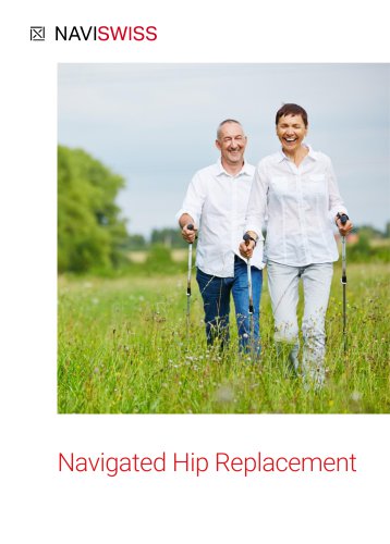 Navigated Hip Replacement