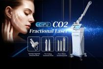 EXFU CO2-vertical