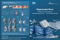 RB03 Regenerative Bone Brochure