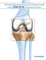 ACL Reconstruction Surgical Technique Guide Using Interference Screw