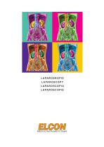 Laparoscopy