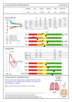 Report Output ALDS limitation