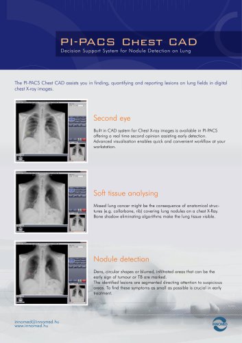 PI-PACS Chest CAD