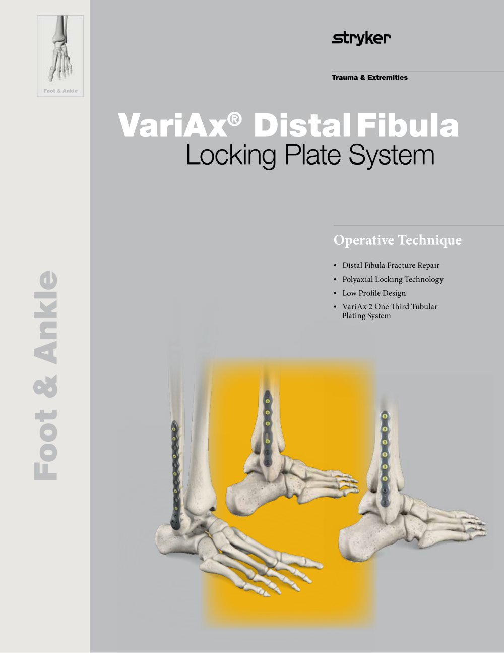 VariAx&reg; DistalFibula - Stryker