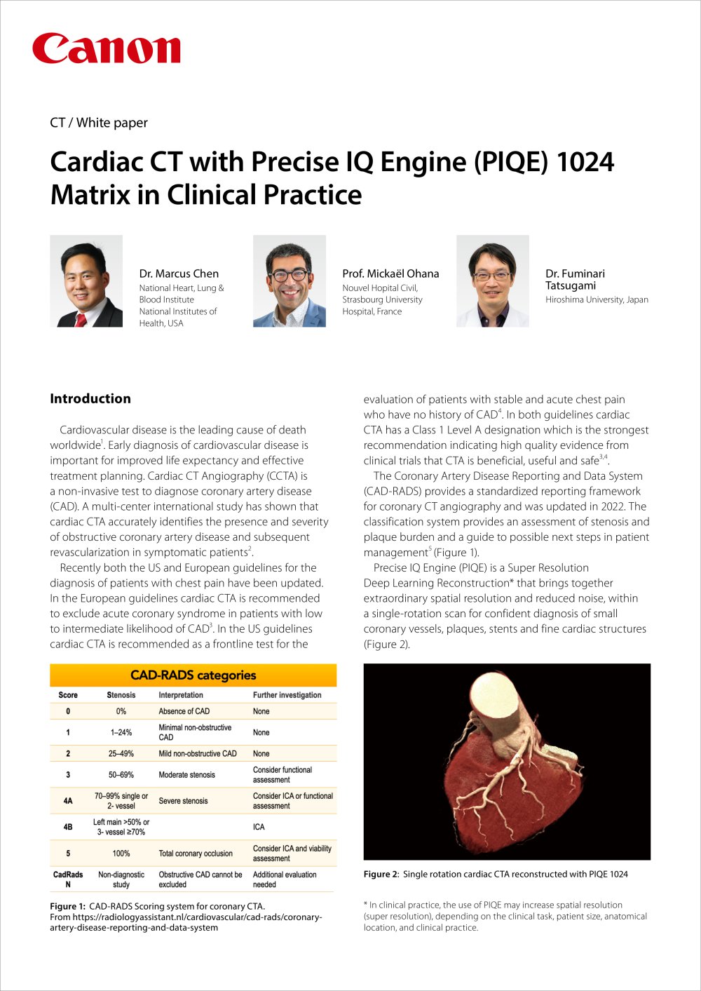 https://eu.medical.canon/products/computed-tomography/piqe/ - Canon Medical Systems Europe