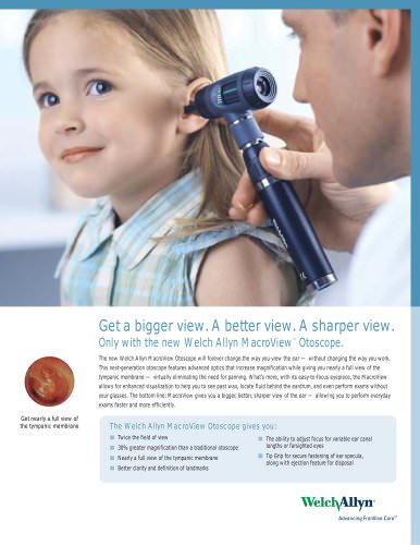 Welch Allyn MacroView? Otoscope