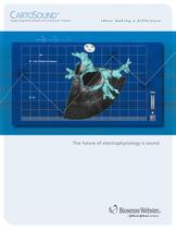 CARTOSound Image Integration Module with SOUNDSTAR Catheter