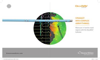 DecaNav? Catheter