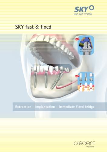 SKY fast & fixed