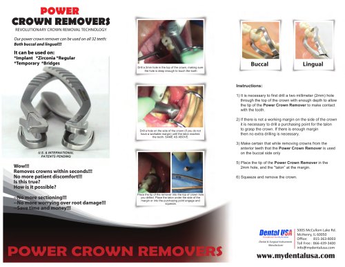 Power Twist Periotomes Brochure