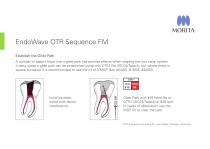 EndoWave OTR Sequence FM