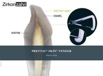 Brochure Prettau® Skin® veneer – step by step