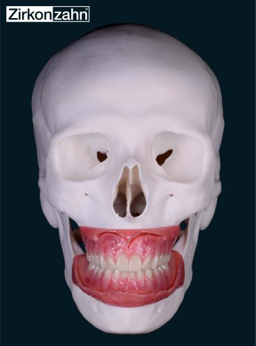 Insert Gingiva-Composites