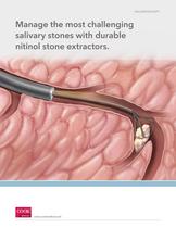 Salivary Stone Extractors