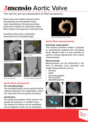 3mensio Aortic valve