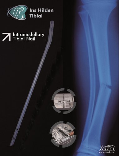 Intramedullary Tibial Nail